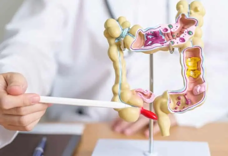 enfermedades inflamatorias colon