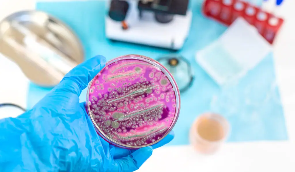 Petri dish with microbial growth held in a lab, illustrating microbiology work in the r&d pharmaceutical industry